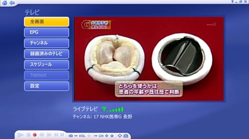 TVチューナー SDB Full Seg HD 电视-MyGica ® S270 地上デジタルチューナー - USBチューナーレシーバーテレビスティック360度ダブル伸縮アンテナの特徴・詳細 画像